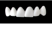 Cod.E4UPPER ANTERIOR : 10x  wax facings-bridges (hollow), MEDIUM, Triangular, (13-23), compatible with solid (not  hollow) wax bridges Cod.S4UPPER ANTERIOR, (13-23)
